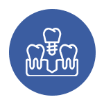Dental Implants & Prosthetics