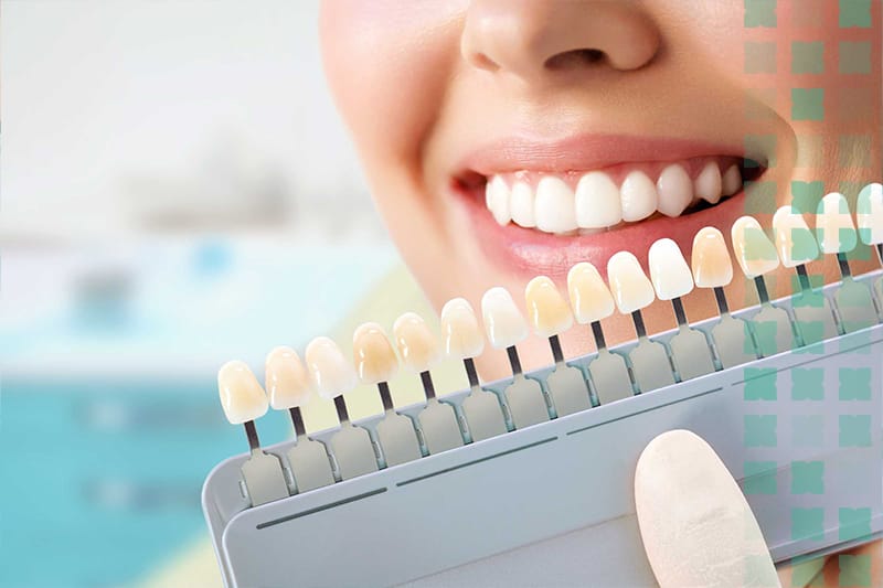 Cosmetic Dentistry in Al Ain and Digital Smile Design