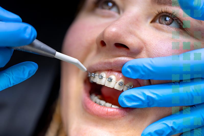 Digital Orthodontics in Al Ain