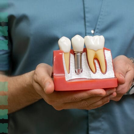 Dental Implants in Al Ain